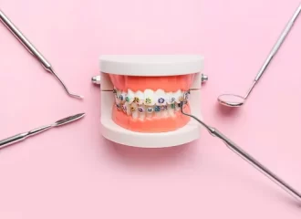 矯正を始めるベストなタイミングはいつ？後悔しない判断ポイントを解説